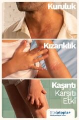 Mustela Stelatopia Cream 150 ml SKT:04.28